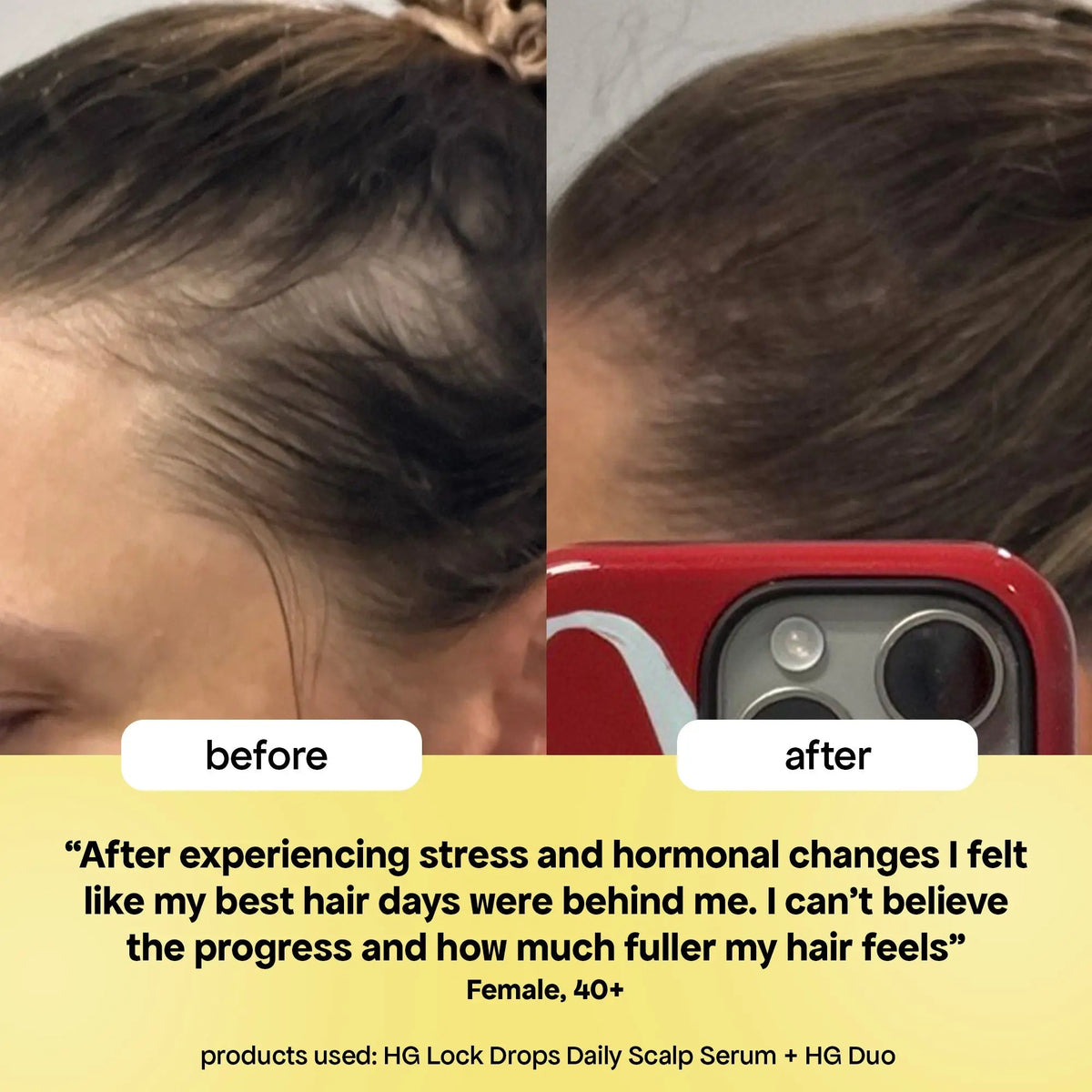 LOCK DROPS ANTI-SHEDDING SCALP & HAIR SERUM