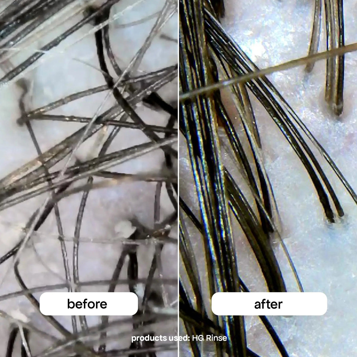 HAIR EXTENSION SYSTEM
