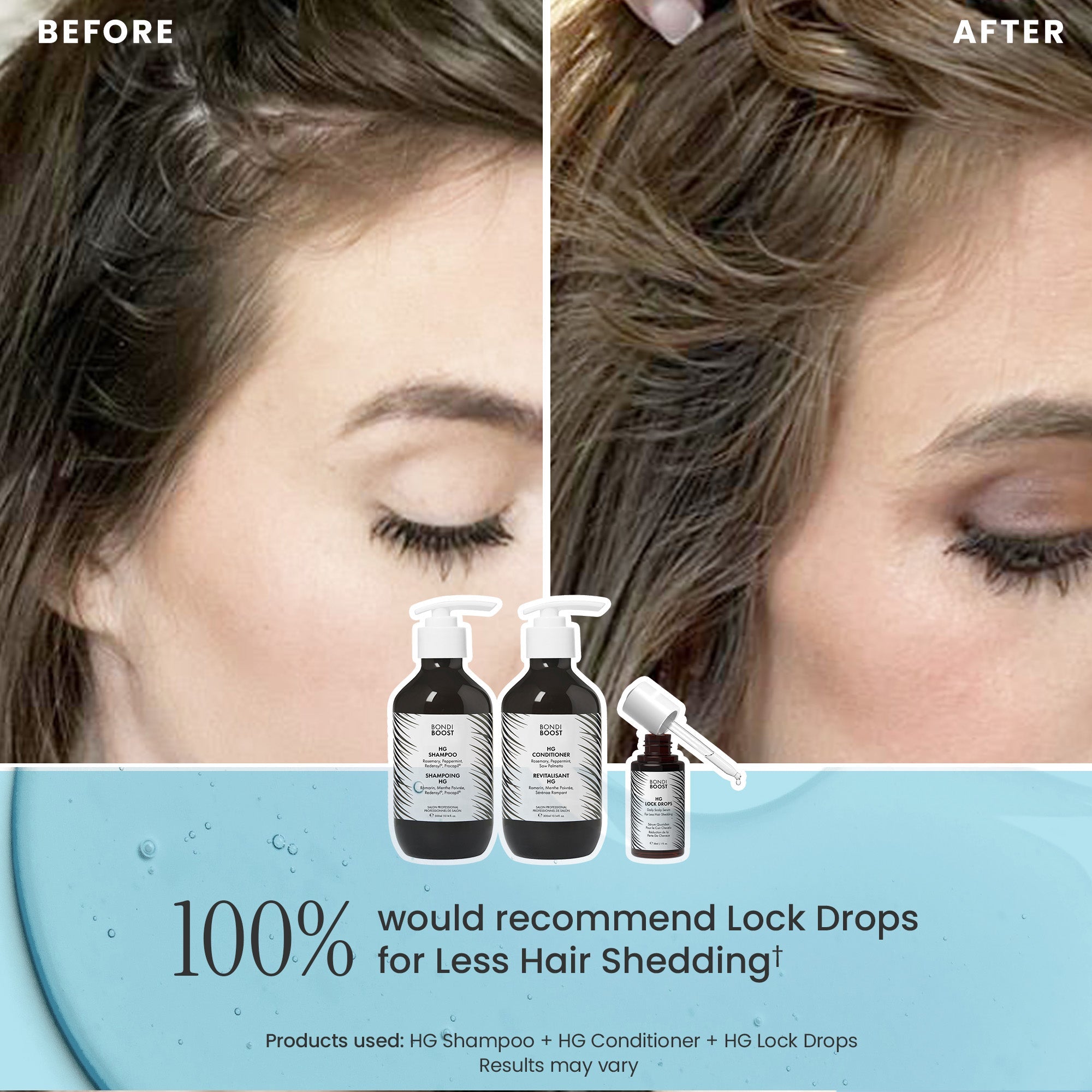ANTI-THINNING BEST SELLER