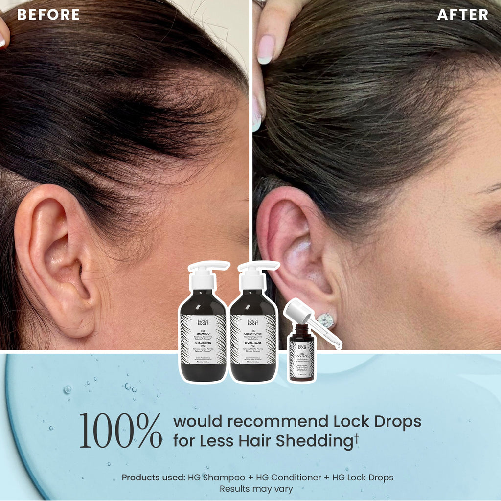 ANTI-THINNING BEST SELLER