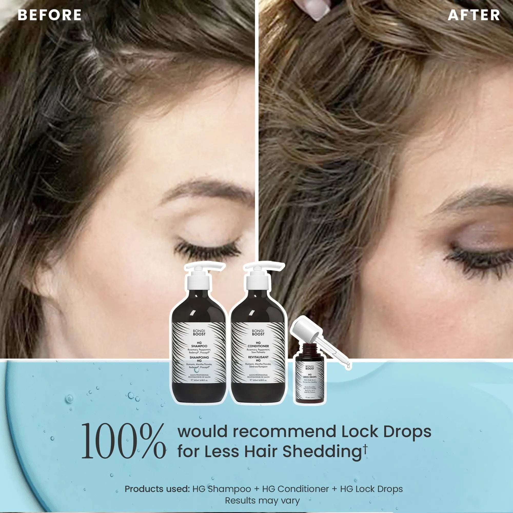 ANTI-THINNING BEST SELLER (500ml+60ml)