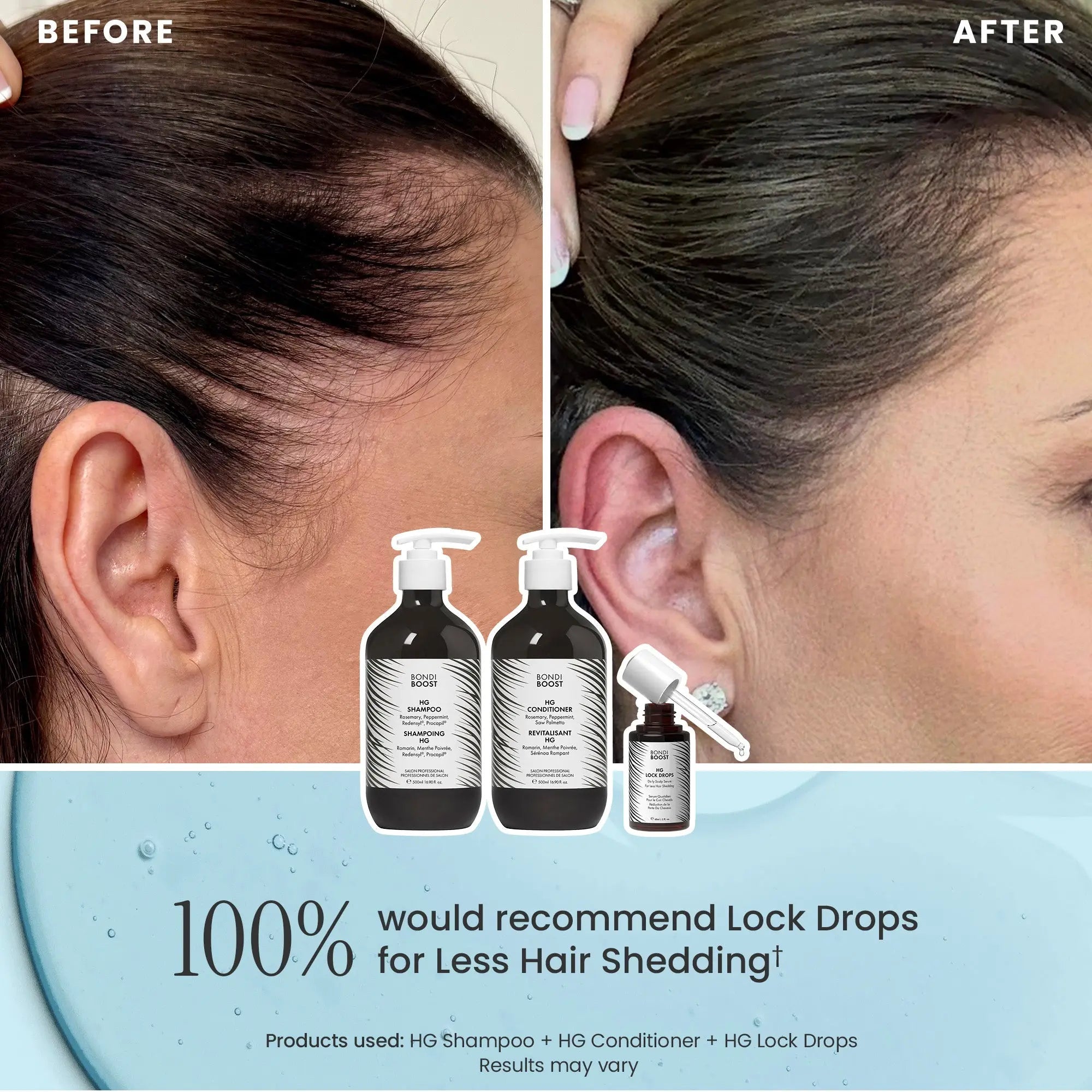 ANTI-THINNING BEST SELLER (500ml+60ml)