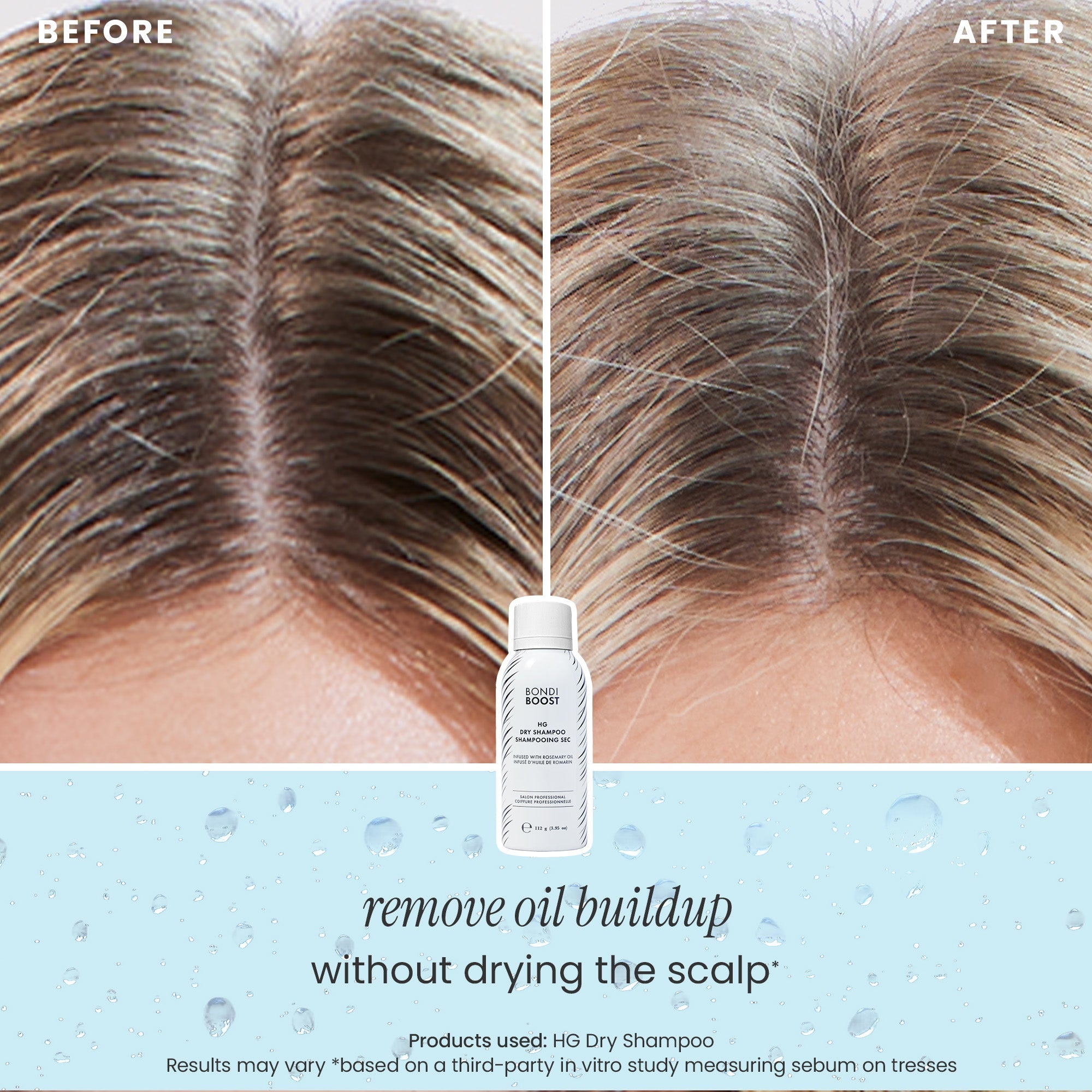 DRY SHAMPOO